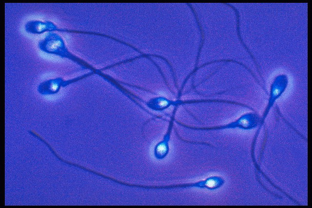 сперматозоиди